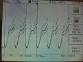 Click image for larger version

Name:	air_core_waveform.jpg
Views:	110
Size:	48.0 KB
ID:	445285