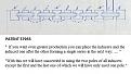 Click image for larger version

Name:	Zoom_patent_57955_year_1914.jpg
Views:	526
Size:	78.6 KB
ID:	457475
