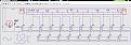 Click image for larger version

Name:	Fig 20 step cir Resistors.jpg
Views:	32
Size:	101.9 KB
ID:	458479