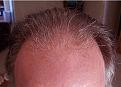 Click image for larger version

Name:	Kevin After 3.JPG
Views:	124
Size:	32.0 KB
ID:	463170