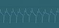 Click image for larger version

Name:	audio-waveform-1.jpg
Views:	165
Size:	21.1 KB
ID:	444758